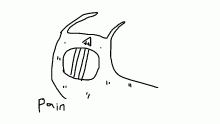 pain
