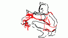 aftercare