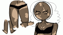 amy vitiligo redesign