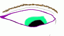 Ughhh Awful Eye!